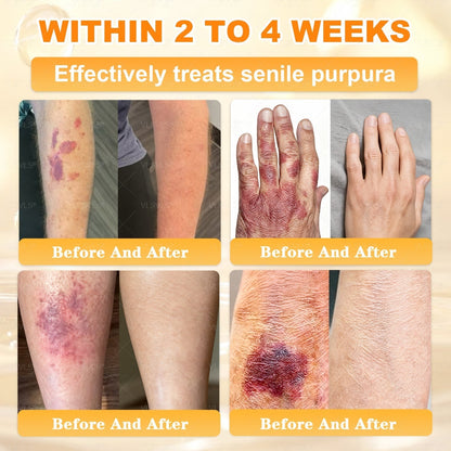 🔥 LAST DAY 80% OFF🔥 Vitalisys® Bee Venom Skin Restoration Cream