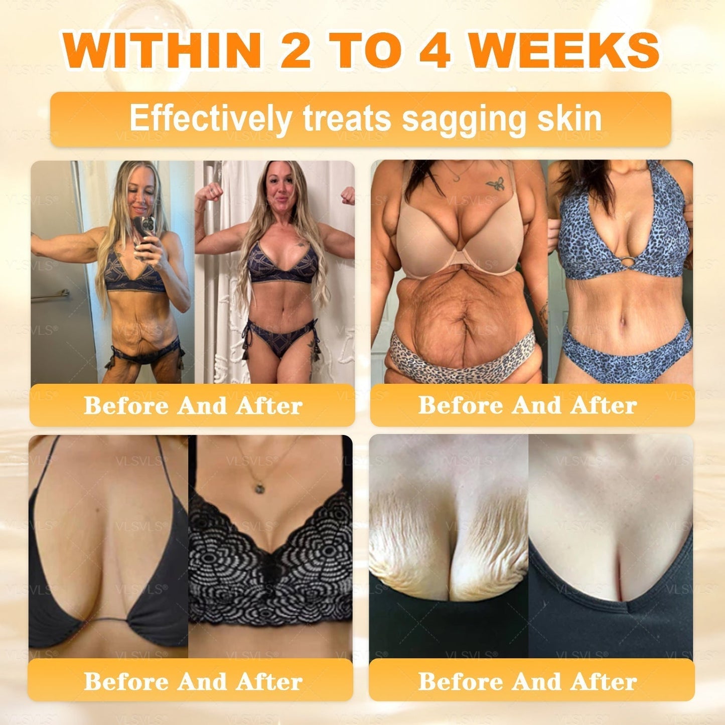 🔥 LAST DAY 80% OFF🔥 Vitalisys® Bee Venom Skin Restoration Cream