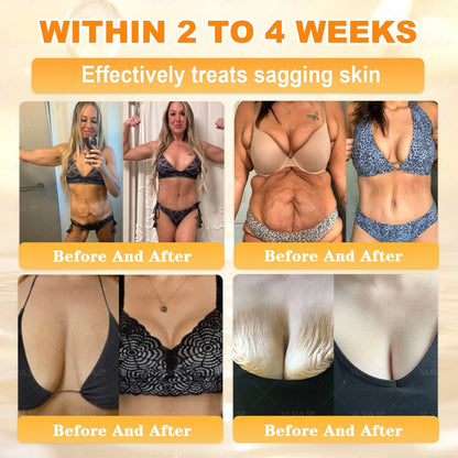 🔥 LAST DAY 80% OFF🔥 Vitalisys® Bee Venom Skin Restoration Cream