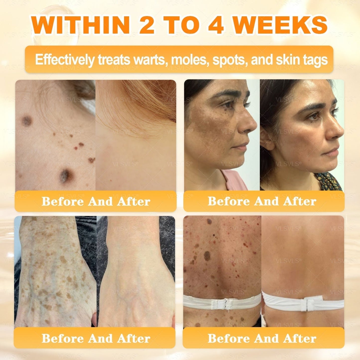 🔥 LAST DAY 80% OFF🔥 Vitalisys® Bee Venom Skin Restoration Cream