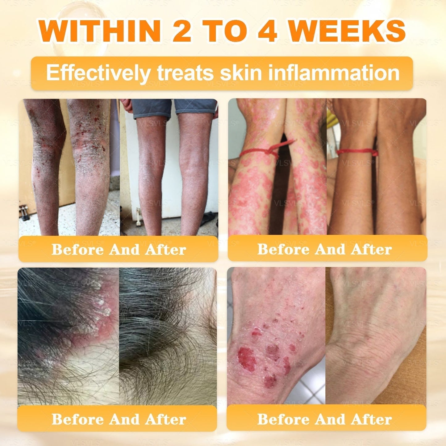 🔥 LAST DAY 80% OFF🔥 Vitalisys® Bee Venom Skin Restoration Cream