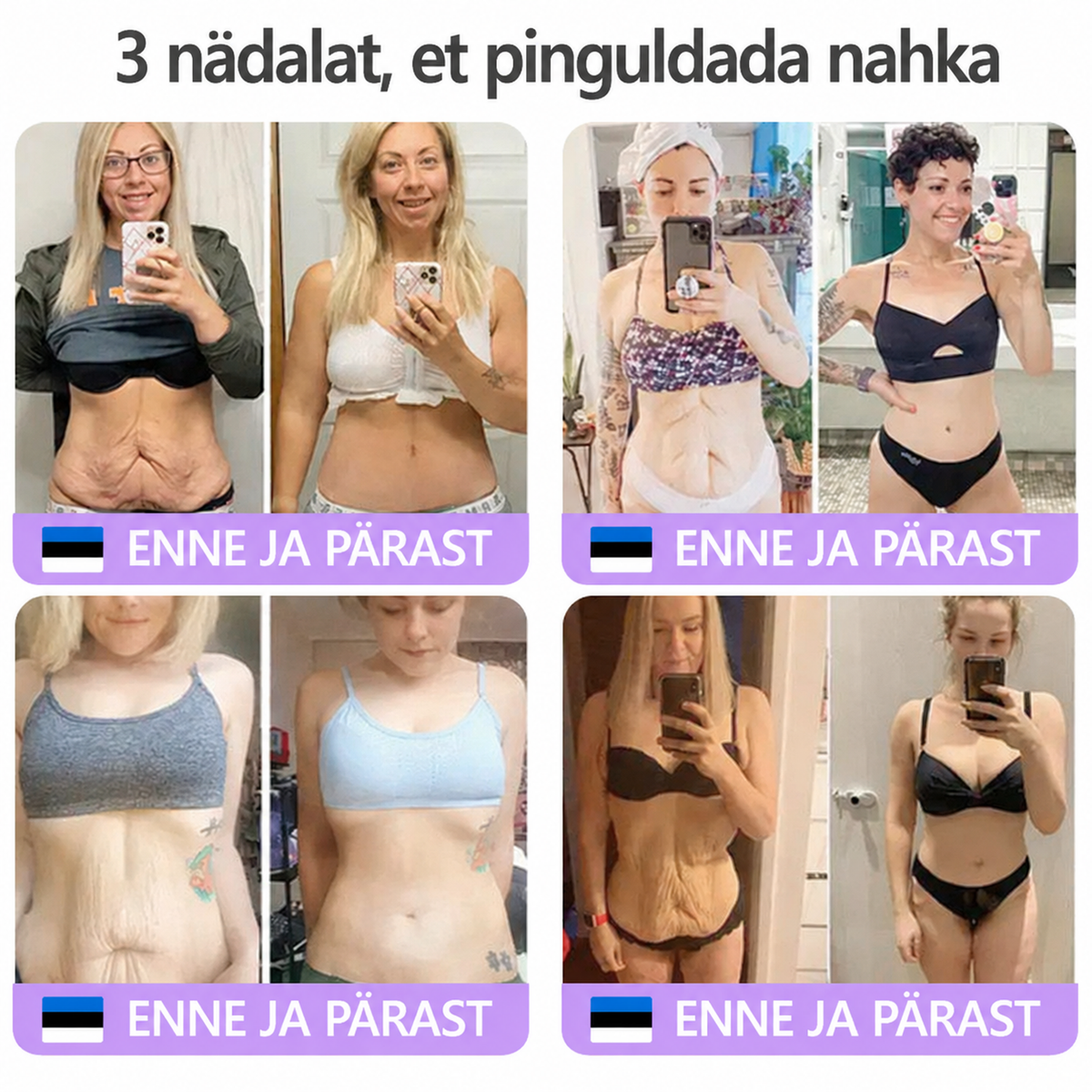 Vitalisys®🔥 PDRN-i ja mitme peptiidiga massaaži-kehakreem aplikaatorrullikuga – vananemisvastane toime; niisutab, pinguldab ja tõstab nahka; soodustab taastumist; ühtlustab nahatooni ning vähendab ebatäiusi ja tumedaid laike.