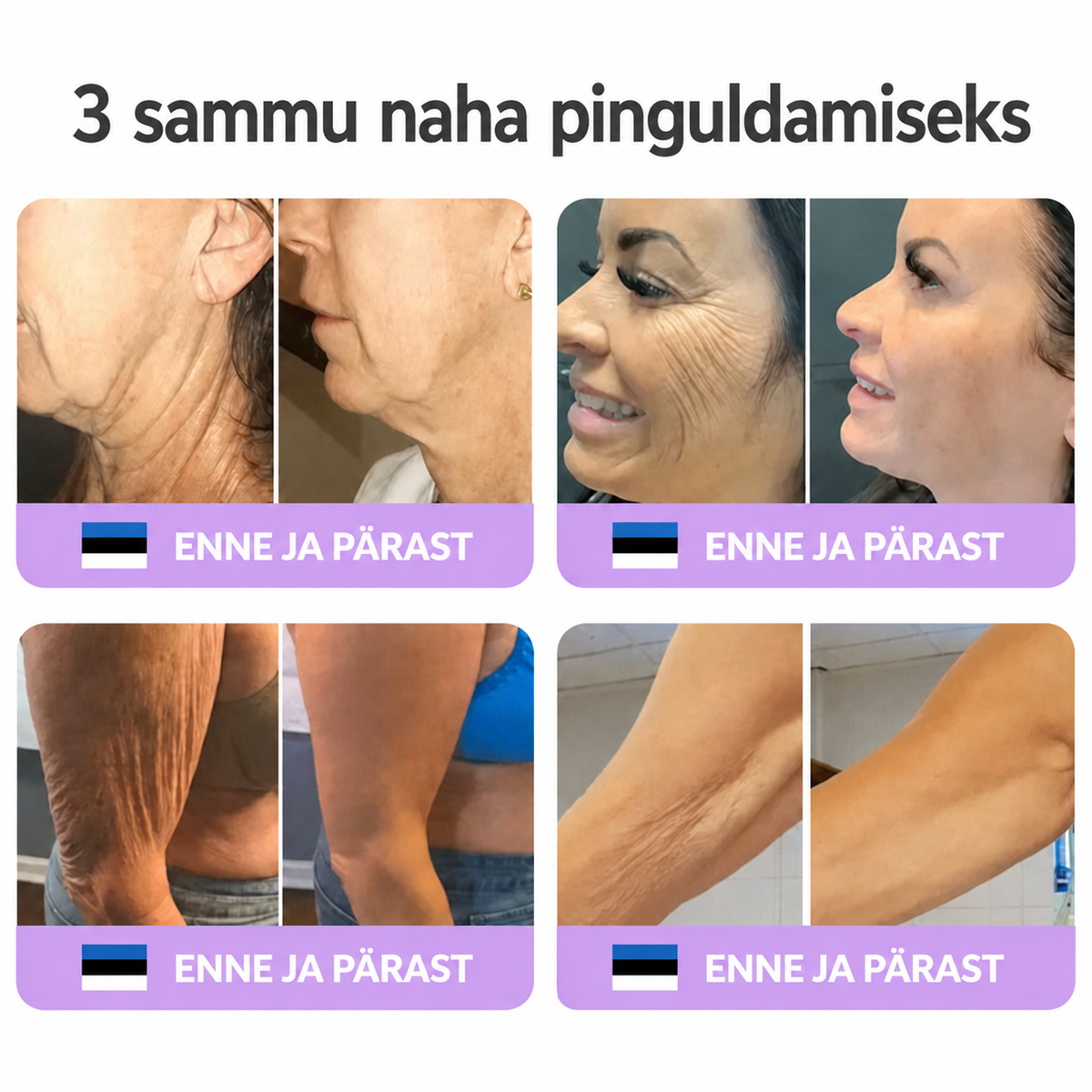 Vitalisys®🔥 PDRN-i ja mitme peptiidiga massaaži-kehakreem aplikaatorrullikuga – vananemisvastane toime; niisutab, pinguldab ja tõstab nahka; soodustab taastumist; ühtlustab nahatooni ning vähendab ebatäiusi ja tumedaid laike.