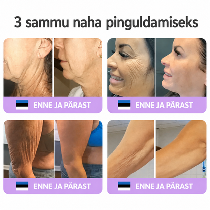 Vitalisys®🔥 PDRN-i ja mitme peptiidiga massaaži-kehakreem aplikaatorrullikuga – vananemisvastane toime; niisutab, pinguldab ja tõstab nahka; soodustab taastumist; ühtlustab nahatooni ning vähendab ebatäiusi ja tumedaid laike.