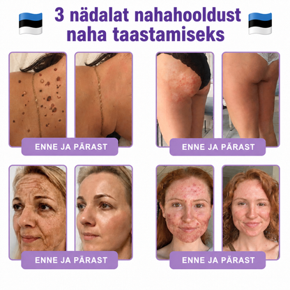 Vitalisys®🔥 PDRN-i ja mitme peptiidiga massaaži-kehakreem aplikaatorrullikuga – vananemisvastane toime; niisutab, pinguldab ja tõstab nahka; soodustab taastumist; ühtlustab nahatooni ning vähendab ebatäiusi ja tumedaid laike.