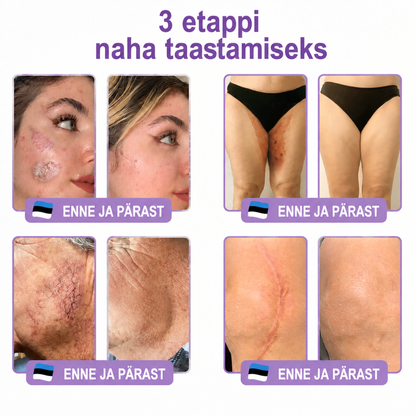 Vitalisys®🔥 PDRN-i ja mitme peptiidiga massaaži-kehakreem aplikaatorrullikuga – vananemisvastane toime; niisutab, pinguldab ja tõstab nahka; soodustab taastumist; ühtlustab nahatooni ning vähendab ebatäiusi ja tumedaid laike.